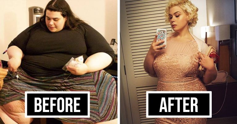 Unbelievable Before and After Weight Loss Images Which will Leave You in Awe