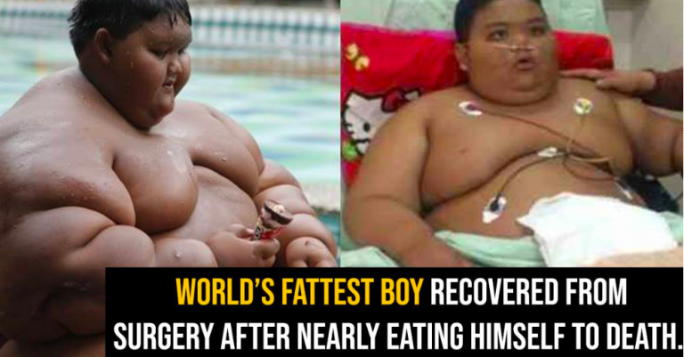 World’s Fattest Boy Recovered From Surgery After Nearly Eating Himself To Death.