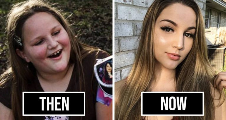 20 Unbelievable ‘2012vs2018’ Transformations In People Which Make Them Totally Unrecognisable.